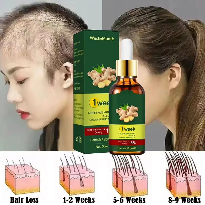 생강 모발 성장 제품, 빠른 모발 재성장 촉진 세럼,  - Licorice Root Sticks 리뷰 및 가격