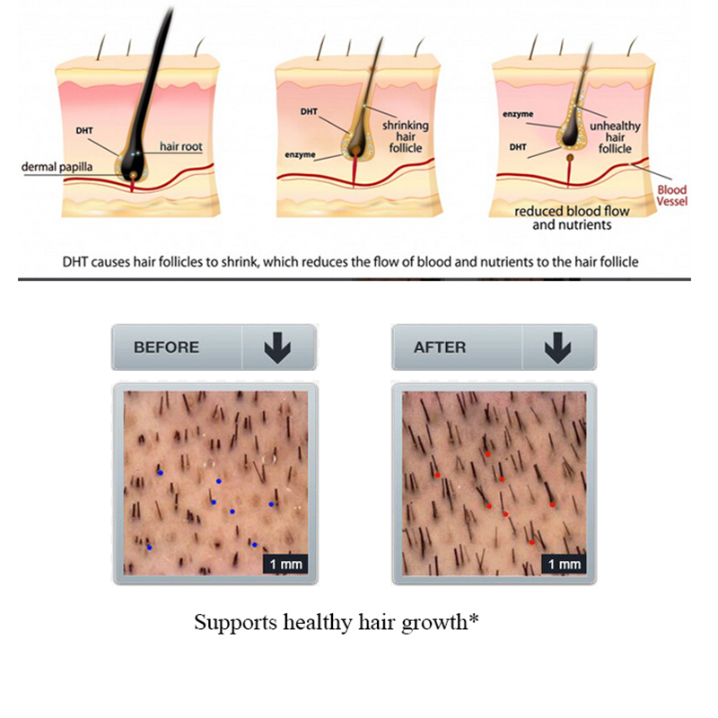 PURC 100ml 생강 탈모 샴푸 모발 재성장 수리를 - Licorice Root Sticks 리뷰 및 가격